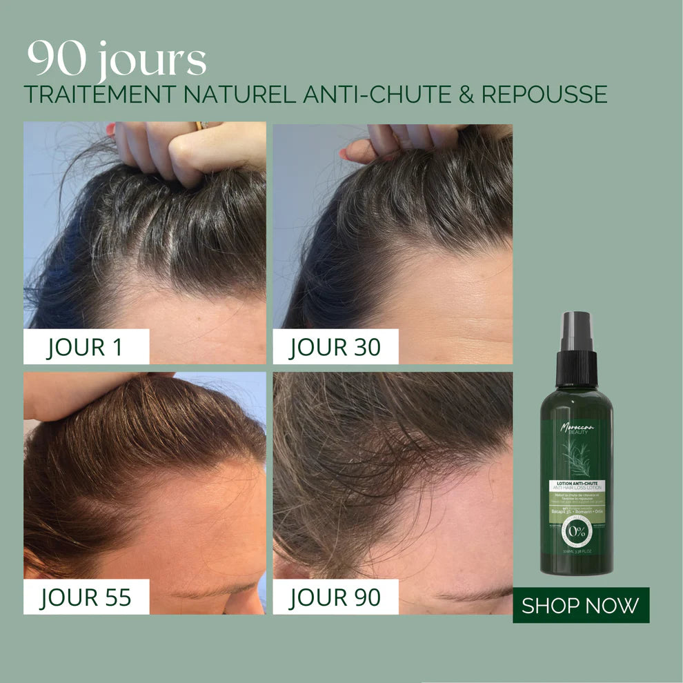 LOTION NATURELLE ANTI-CHUTE & REPOUSSE 100ml
