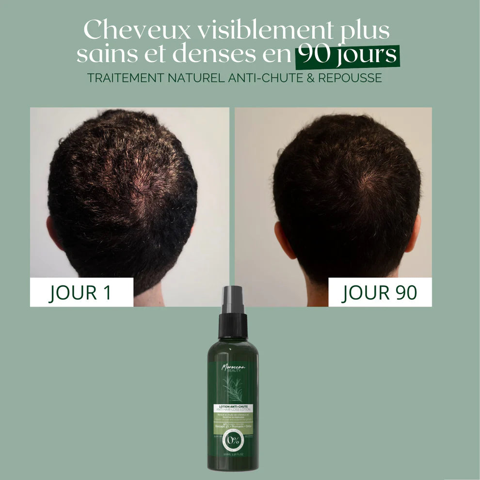 LOTION NATURELLE ANTI-CHUTE & REPOUSSE 100ml